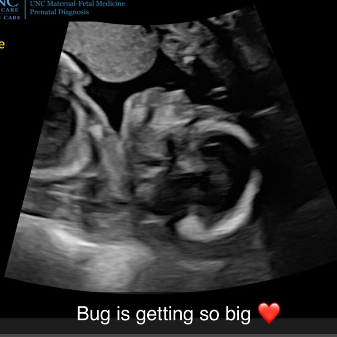 Photo shared by Elizabeth for their Babylist baby registry.