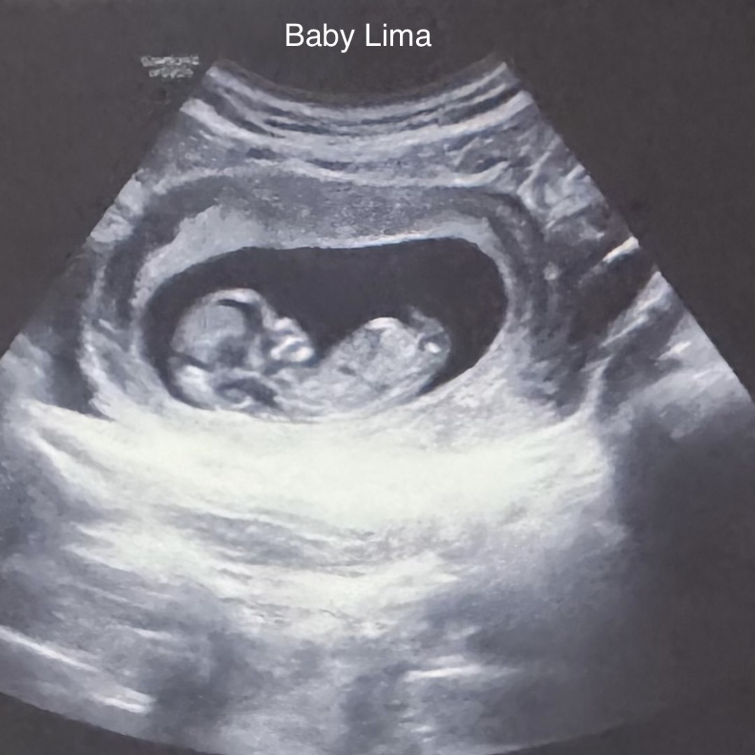 Photo shared by Courtney for their Babylist baby registry.