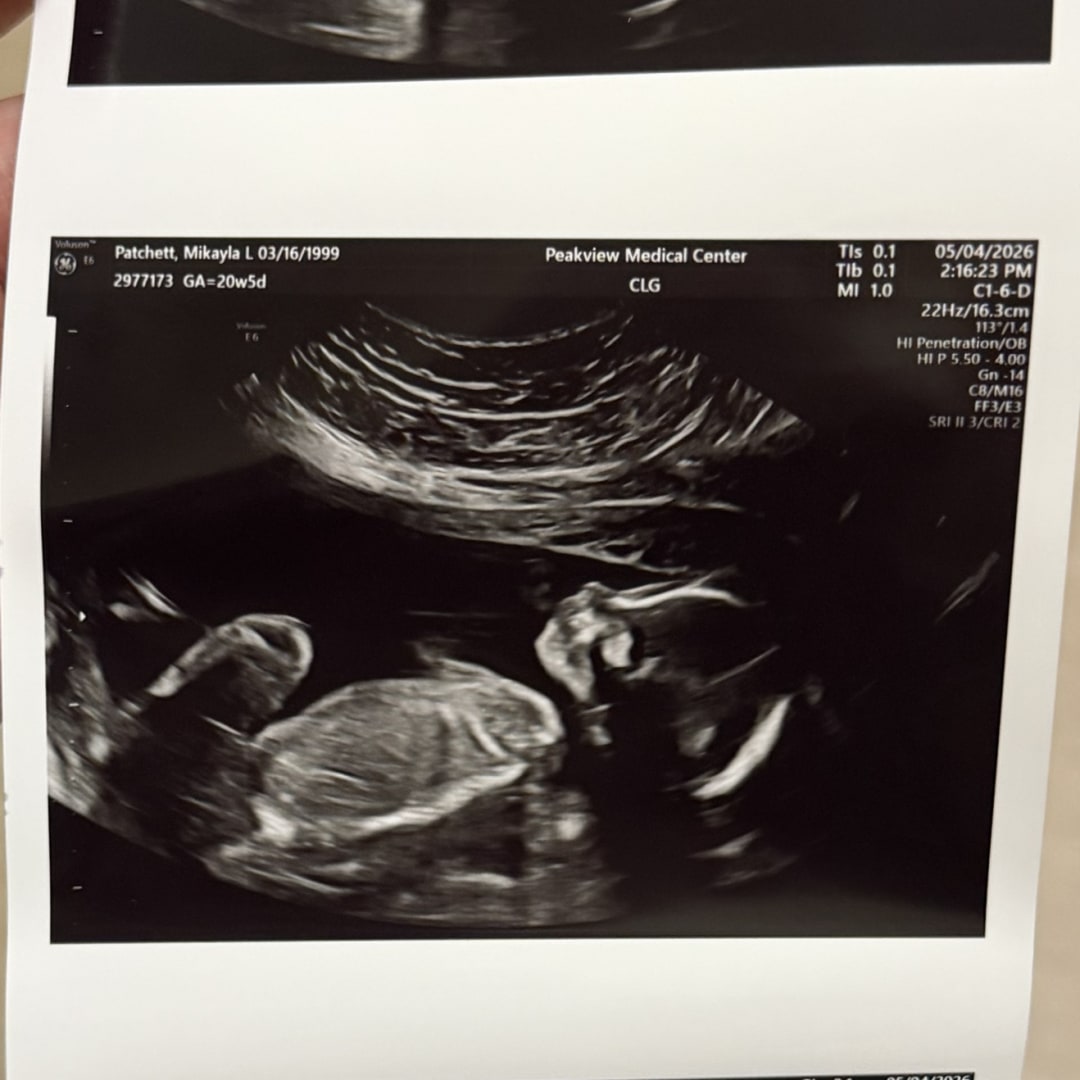 Photo shared by Mikayla for their Babylist baby registry.