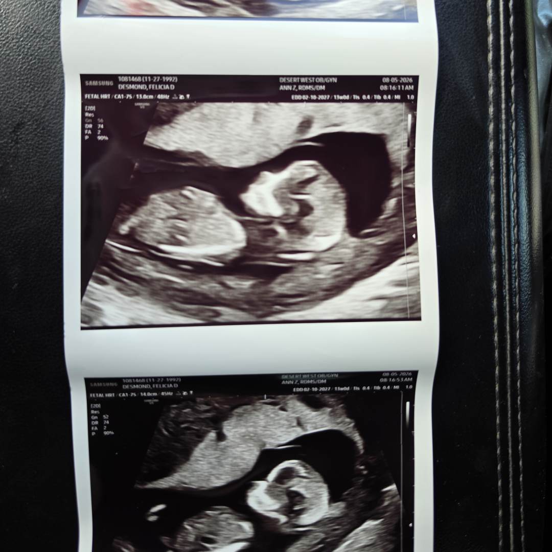 Photo shared by Felicia for their Babylist baby registry.