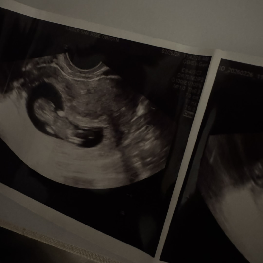 Photo shared by Izzy for their Babylist baby registry.