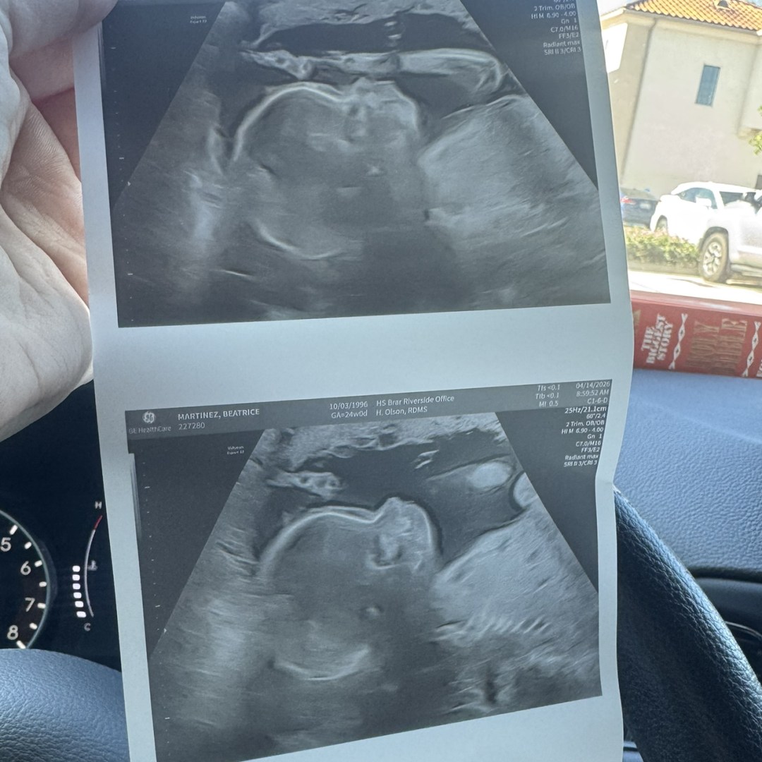 Photo shared by Beatrice for their Babylist baby registry.
