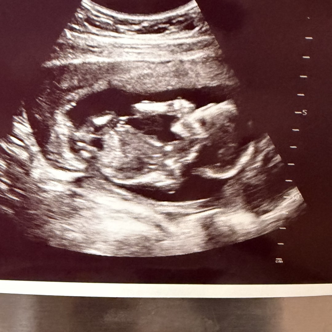 Photo shared by Amyah for their Babylist baby registry.