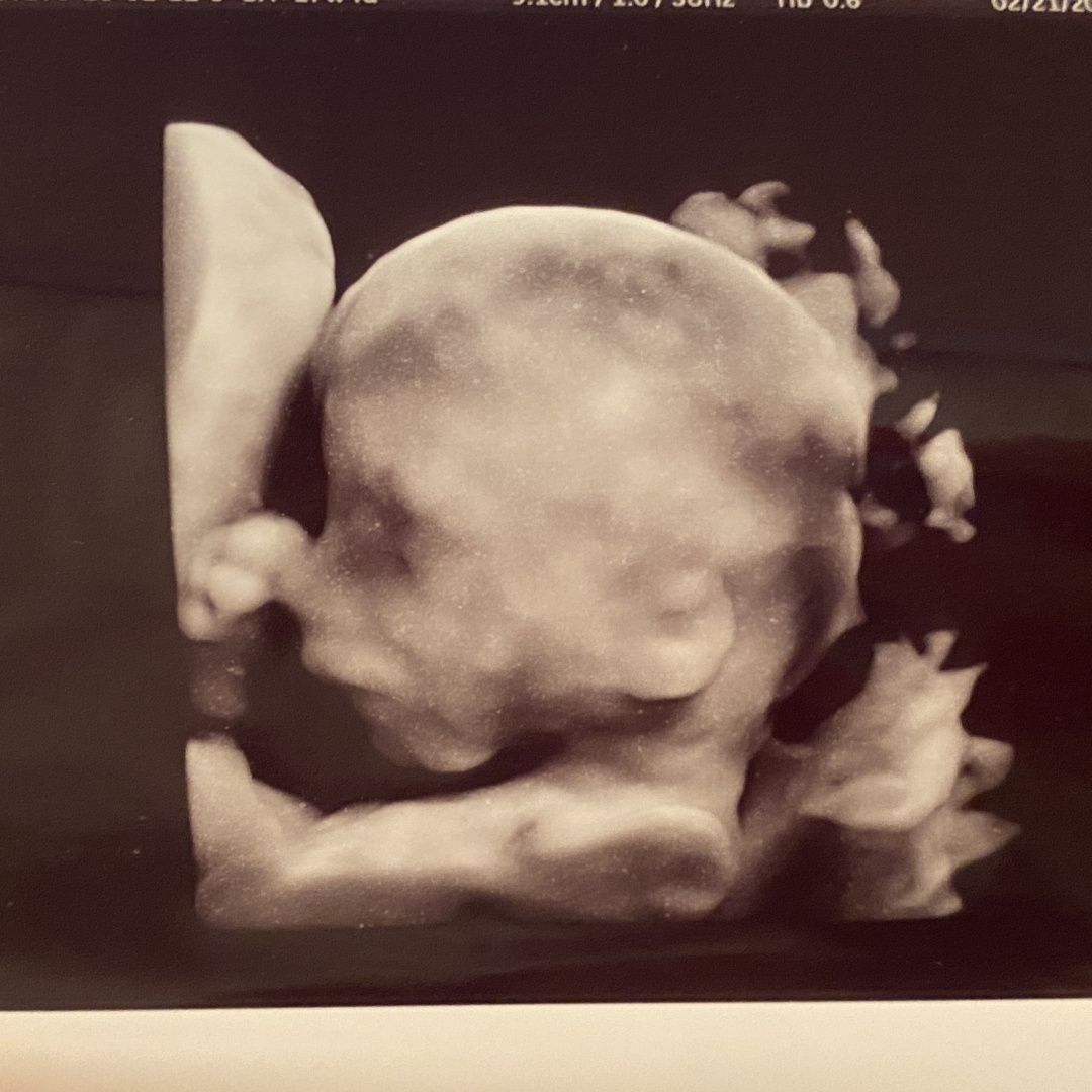 Photo shared by Tiffany for their Babylist baby registry.