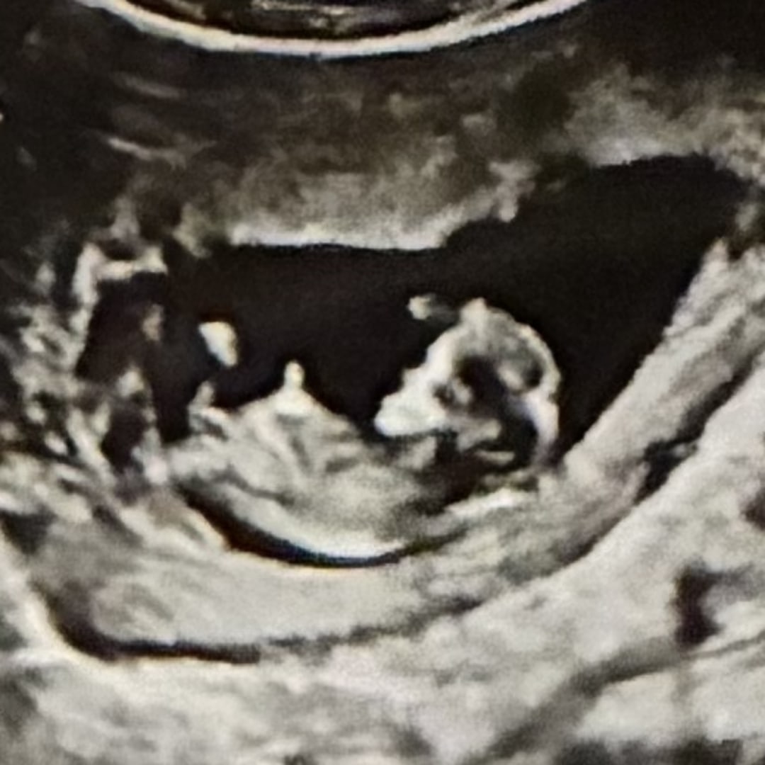 Photo shared by Allayne for their Babylist baby registry.