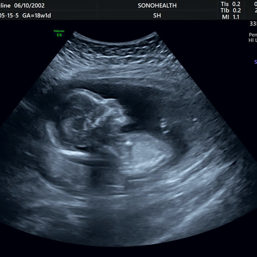 Photo shared by Pauline for their Babylist baby registry.
