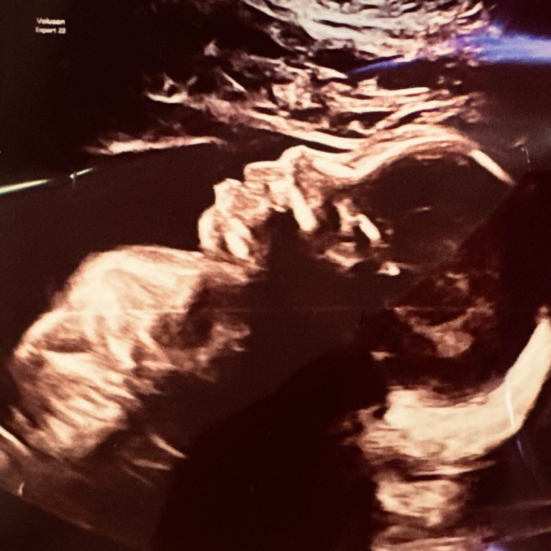 Photo shared by Lindsey for their Babylist baby registry.
