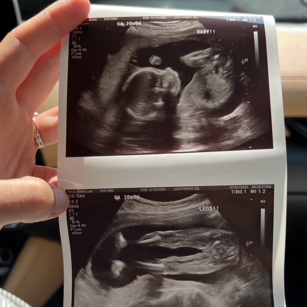Photo shared by Emma for their Babylist baby registry.