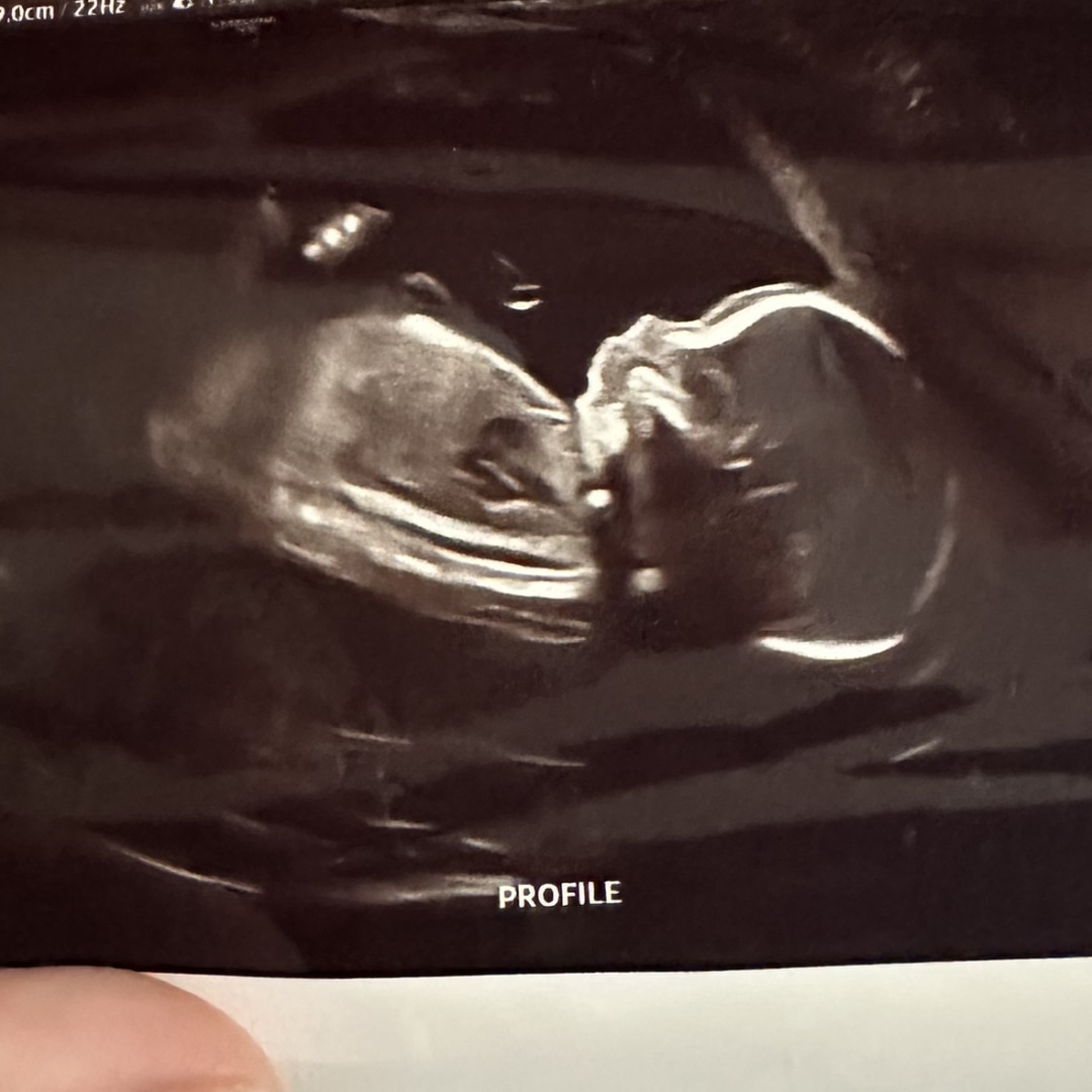 Photo shared by Natalie for their Babylist baby registry.