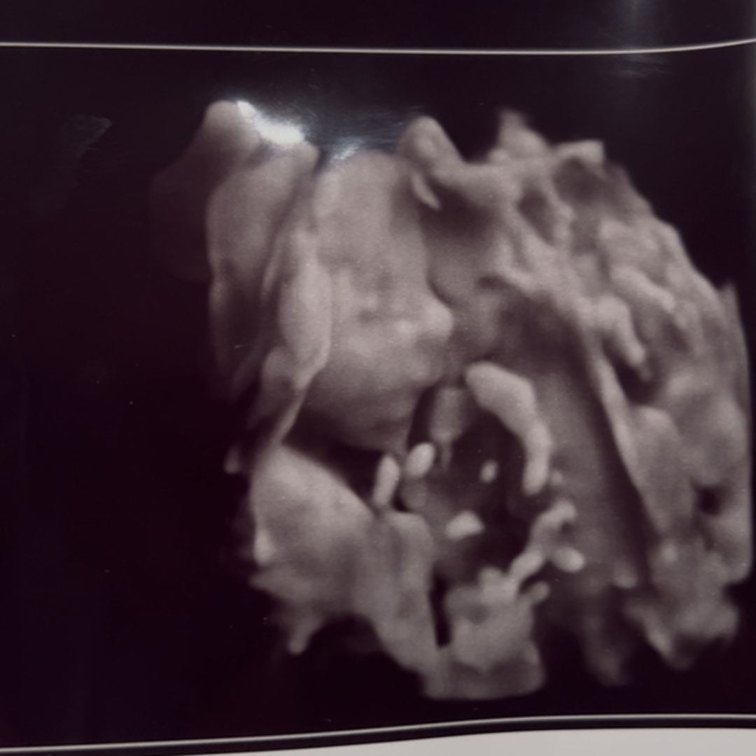 Photo shared by Abbey for their Babylist baby registry.
