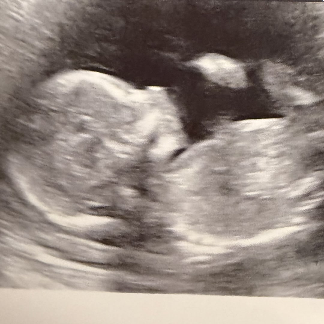 Photo shared by Shara for their Babylist baby registry.