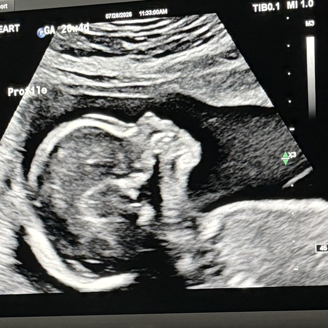 Photo shared by Amanda for their Babylist baby registry.