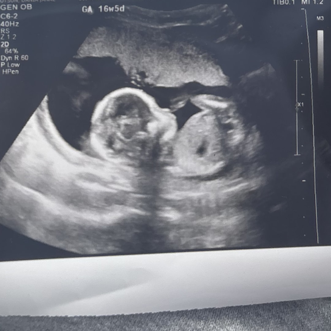 Photo shared by Sevyn for their Babylist baby registry.