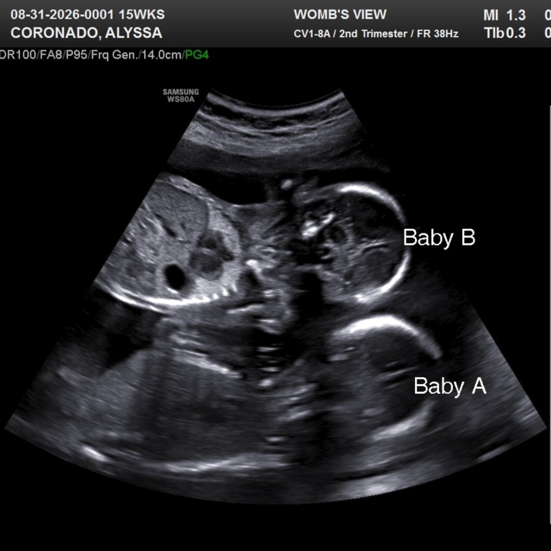 Photo shared by Alyssa for their Babylist baby registry.