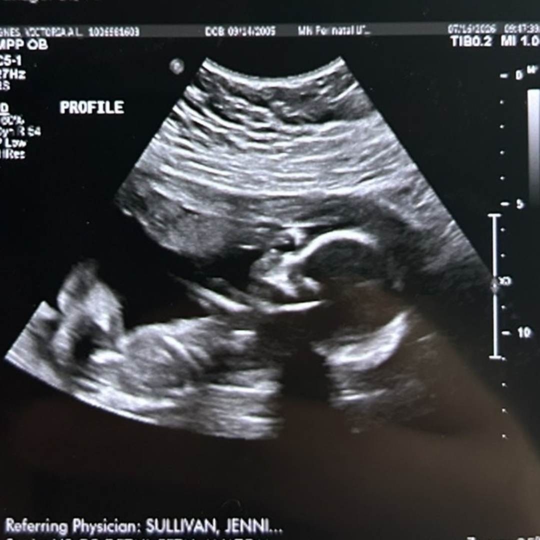 Photo shared by Victoria for their Babylist baby registry.