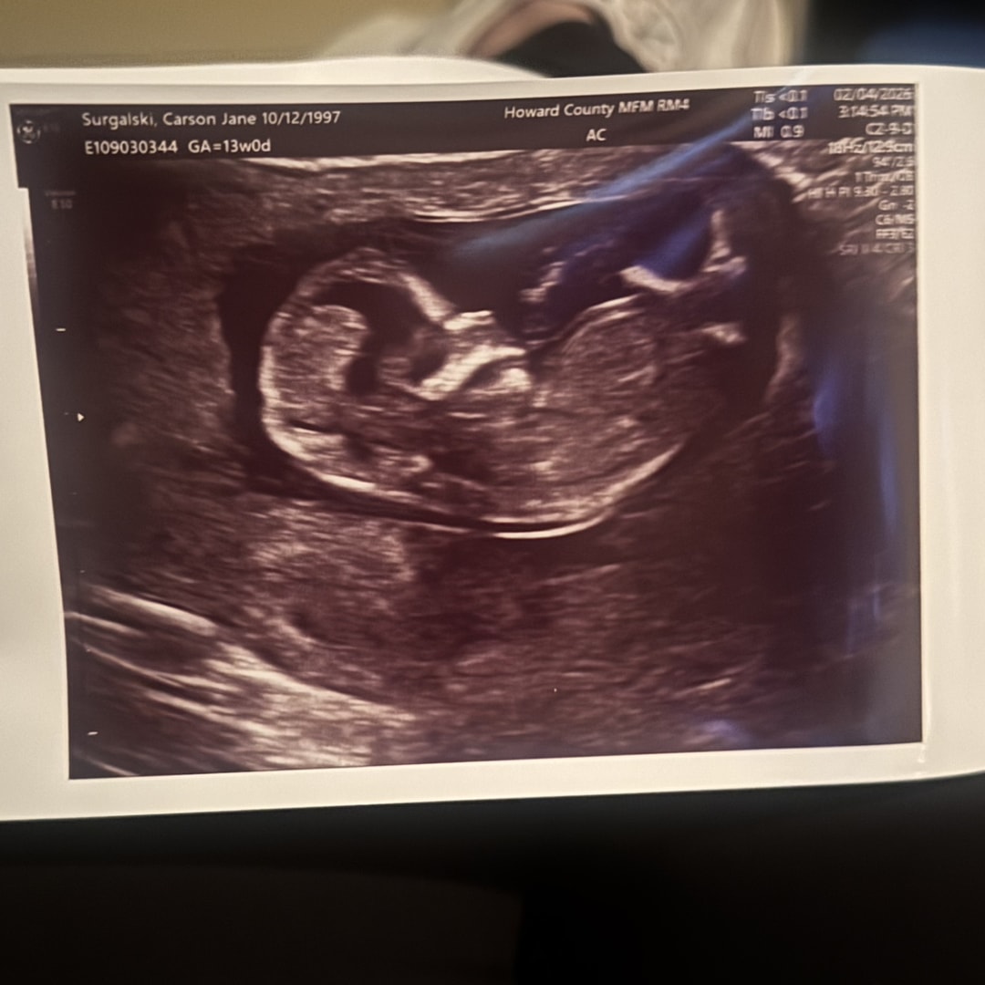 Photo shared by Carson for their Babylist baby registry.