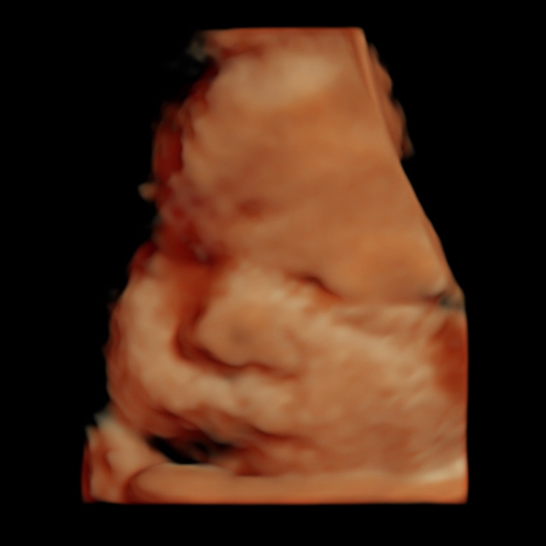 Photo shared by Joanna for their Babylist baby registry.