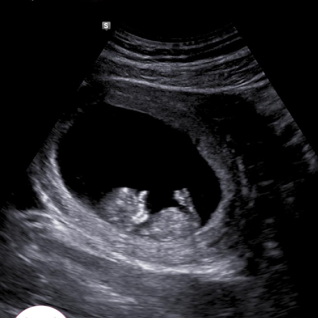 Photo shared by Mackenzie for their Babylist baby registry.