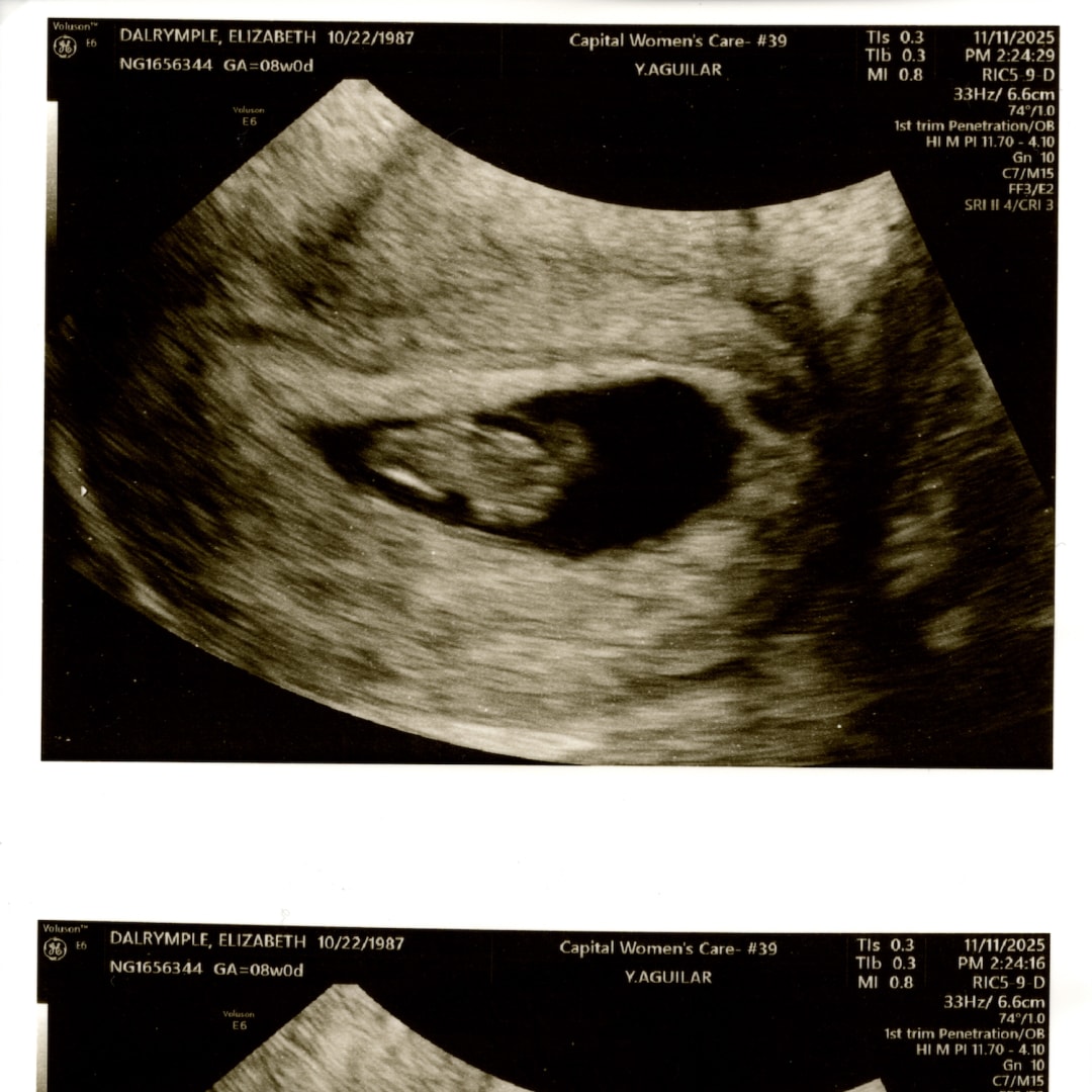 Photo shared by Elizabeth for their Babylist baby registry.