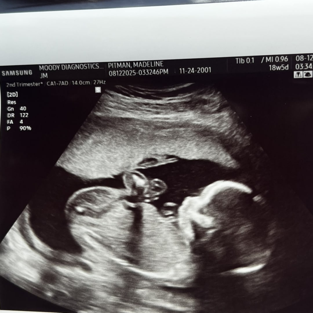 Photo shared by Maddie for their Babylist baby registry.