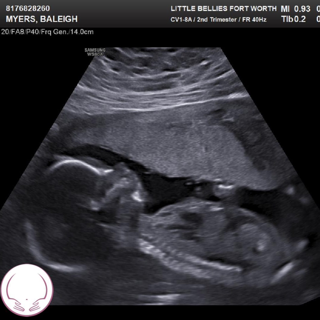 Photo shared by Baleigh for their Babylist baby registry.