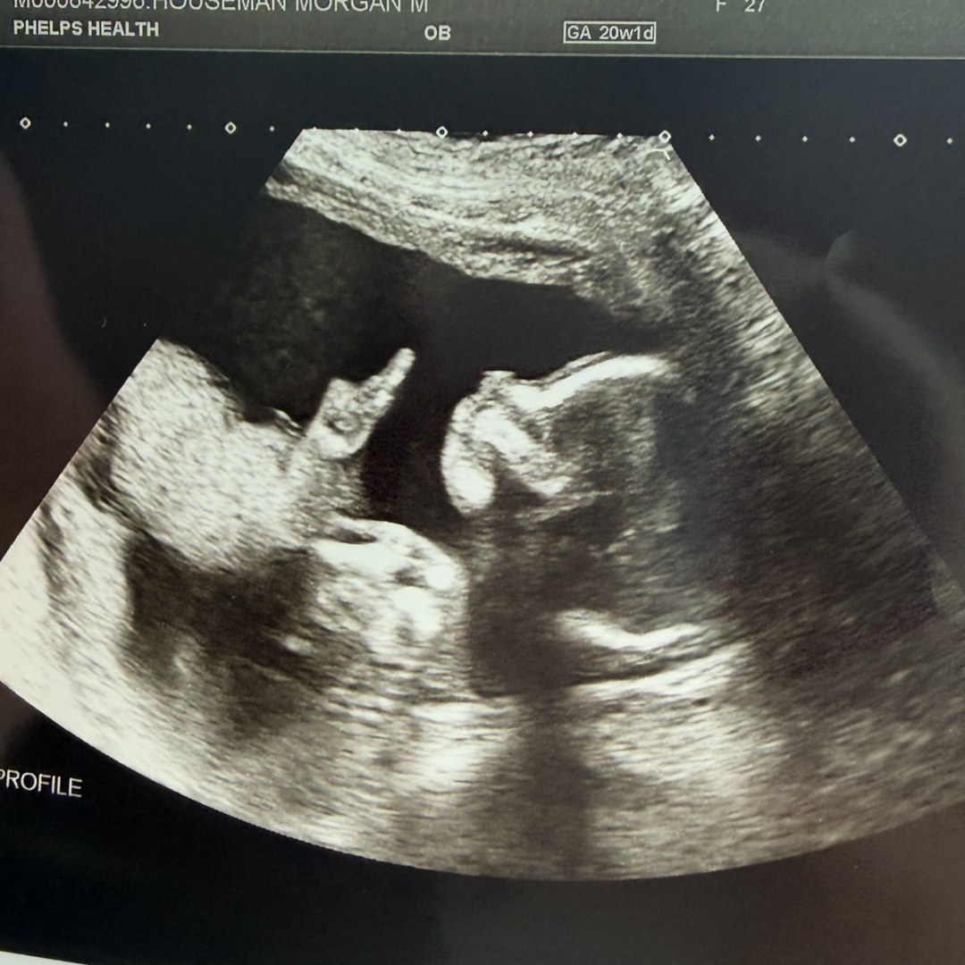 Photo shared by Morgan for their Babylist baby registry.