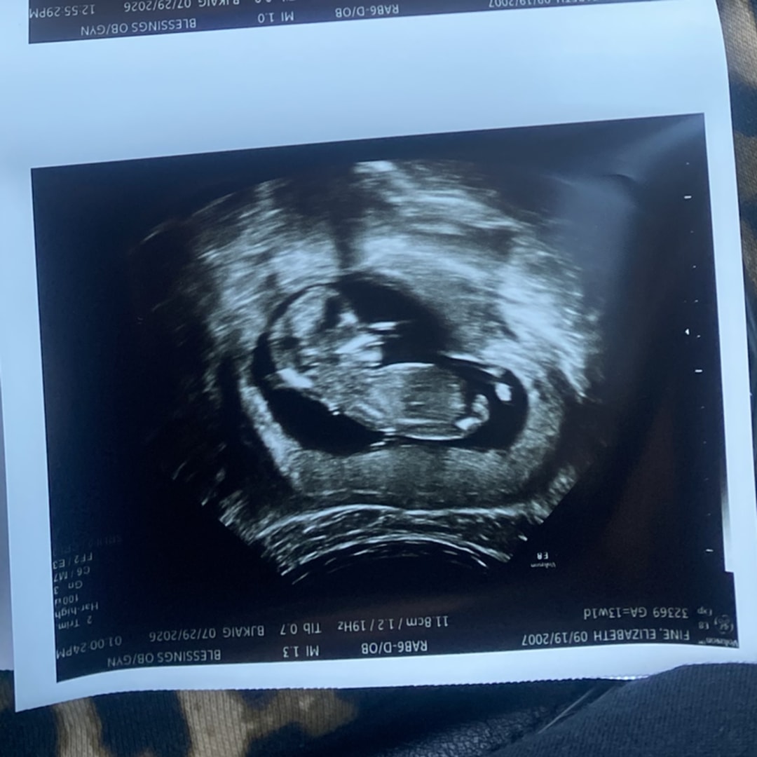 Photo shared by Elizabeth for their Babylist baby registry.