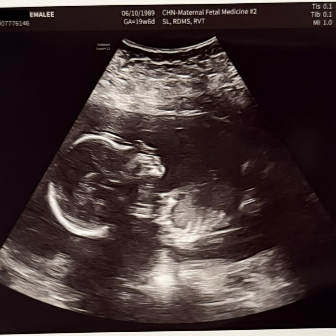 Photo shared by Emalee for their Babylist baby registry.