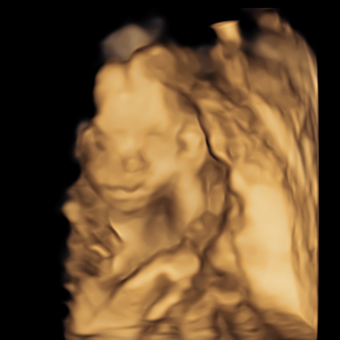 Photo shared by Shiloh for their Babylist baby registry.