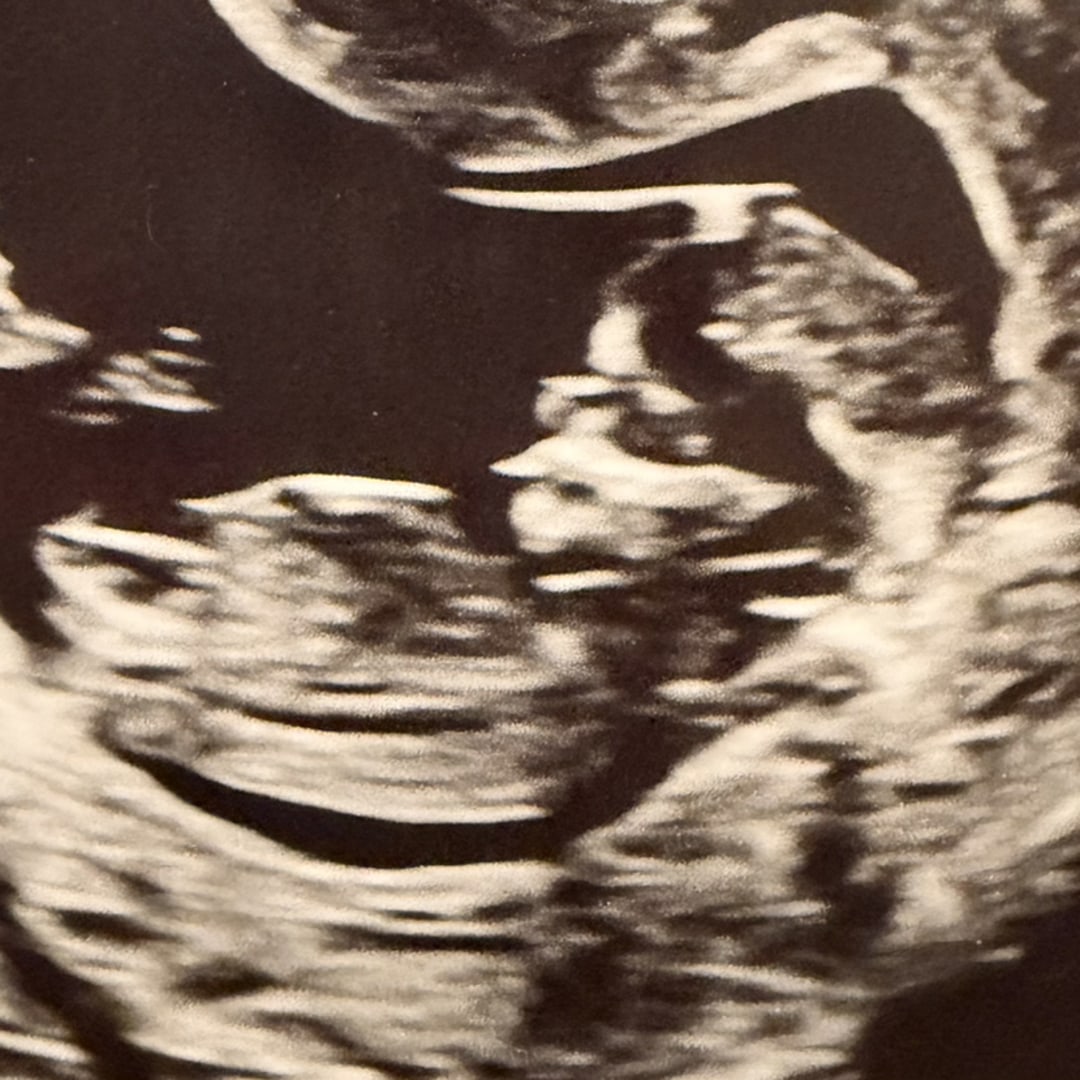 Photo shared by Courtney for their Babylist baby registry.