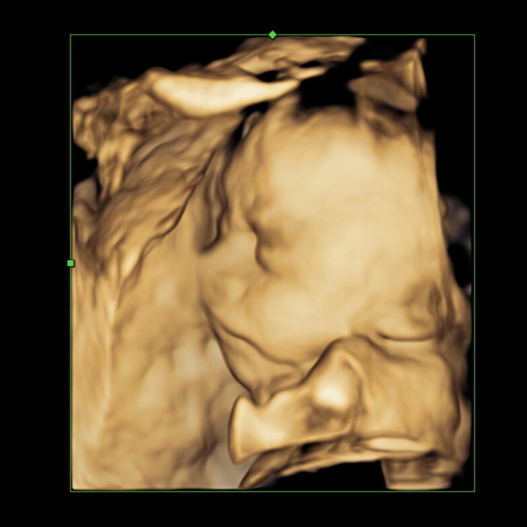 Photo shared by Daniell for their Babylist baby registry.