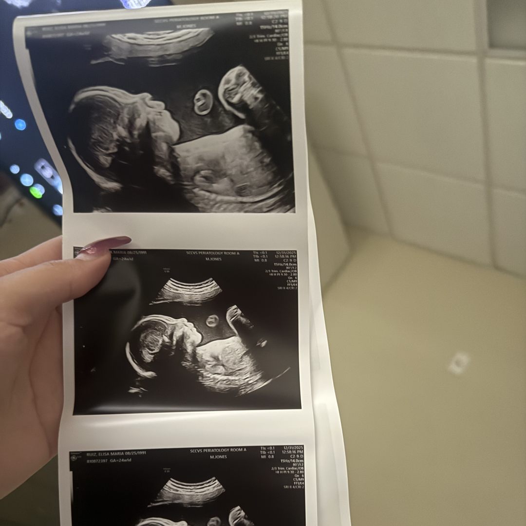 Photo shared by Elisa for their Babylist baby registry.