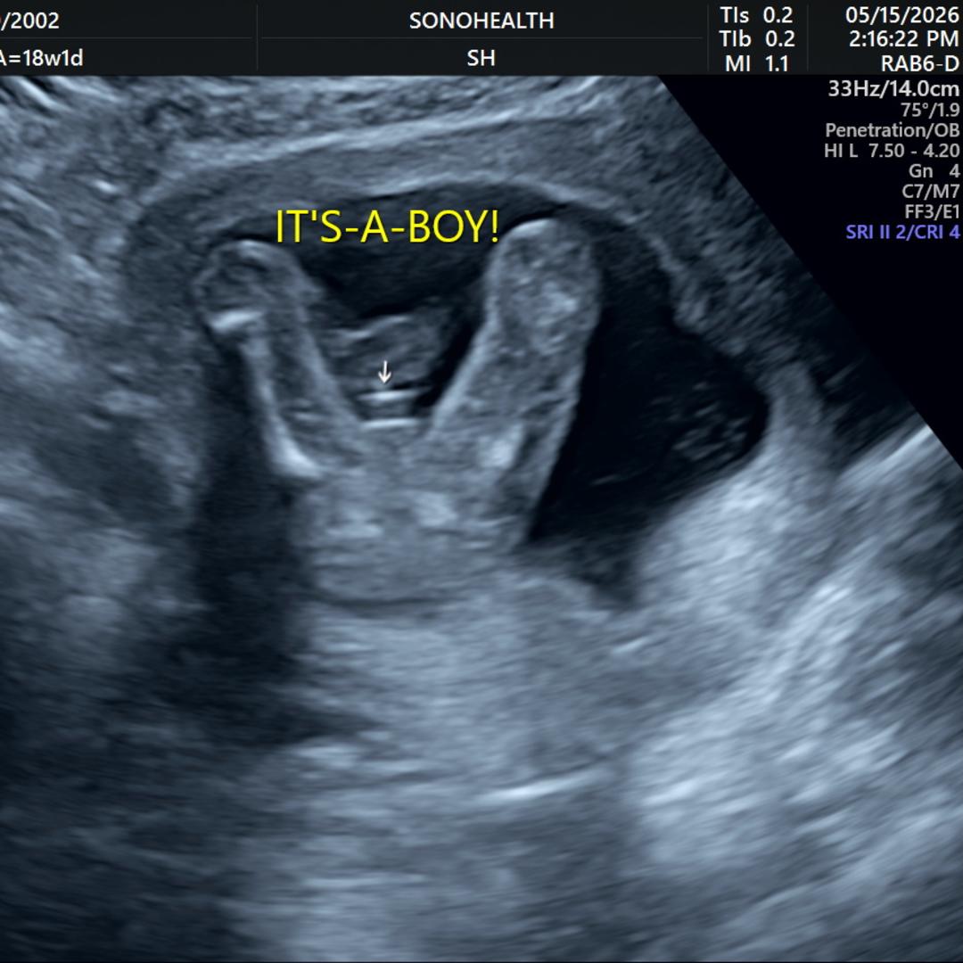 Photo shared by Pauline for their Babylist baby registry.