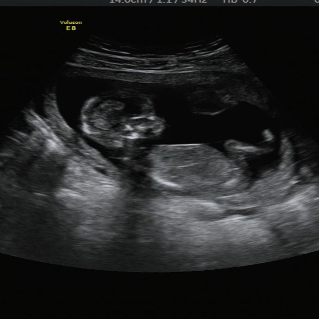Photo shared by Bri for their Babylist baby registry.