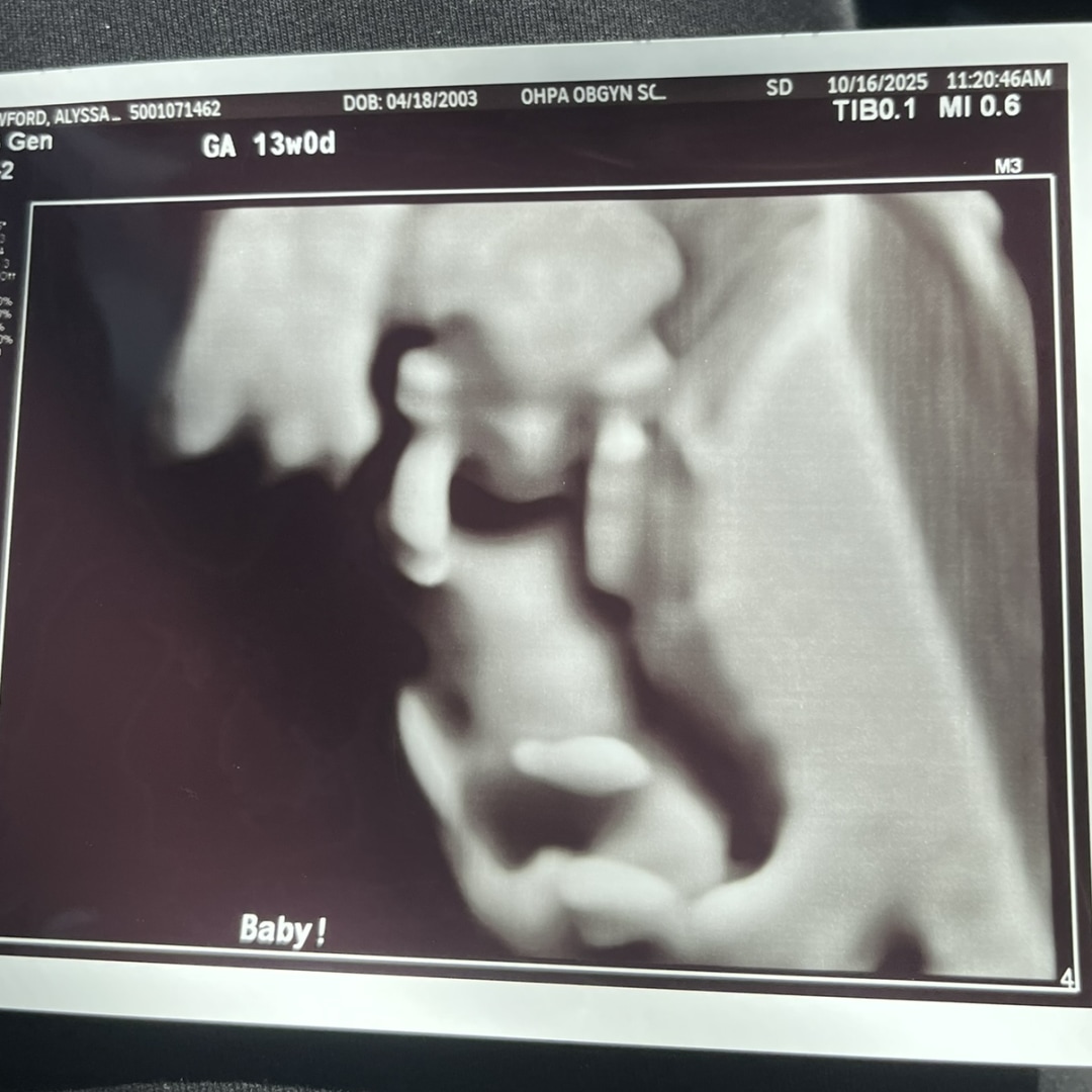 Photo shared by Alyssa for their Babylist baby registry.