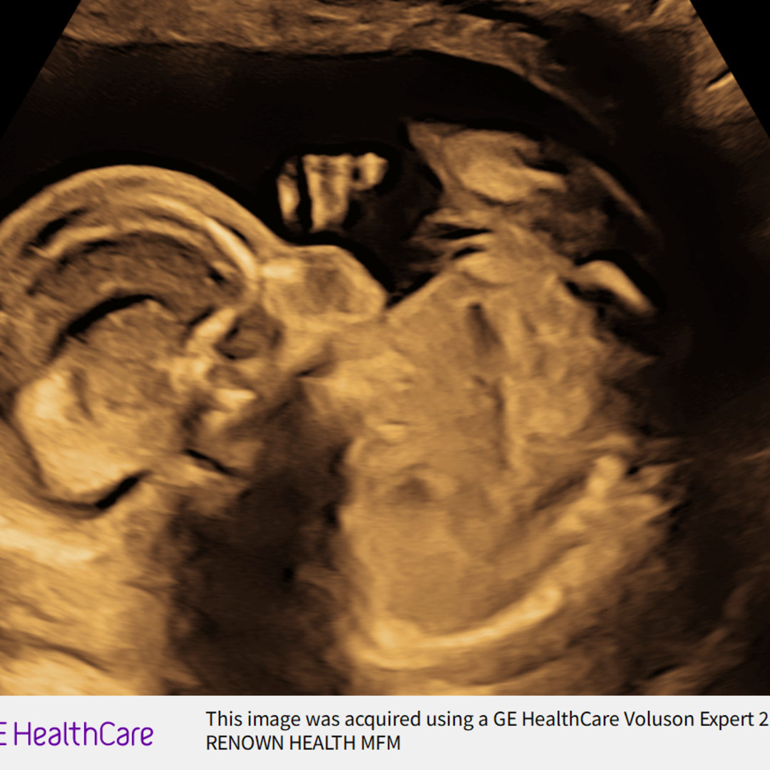 Photo shared by Katie for their Babylist baby registry.