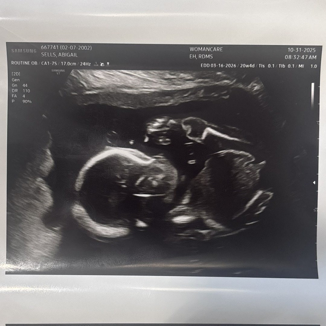 Photo shared by Abby for their Babylist baby registry.