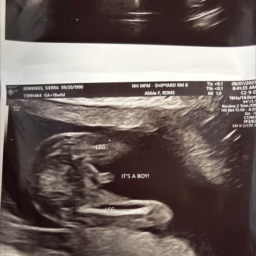 Photo shared by Sierra for their Babylist baby registry.