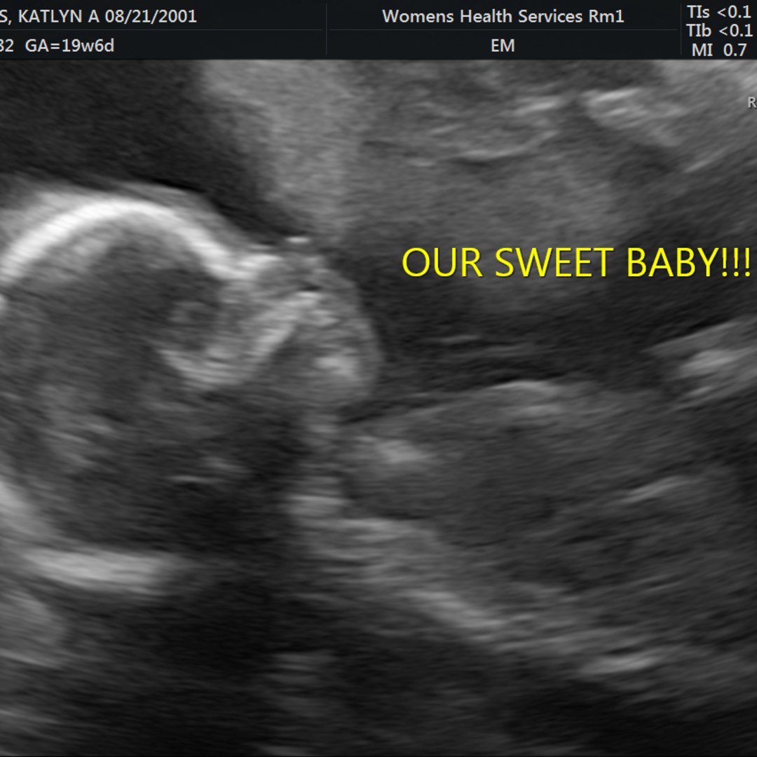 Photo shared by Katlyn for their Babylist baby registry.