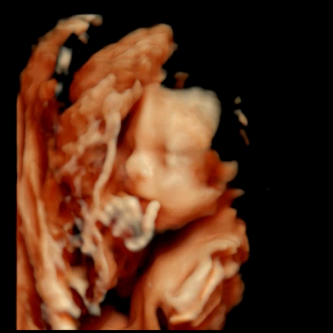 Photo shared by McKenna for their Babylist baby registry.