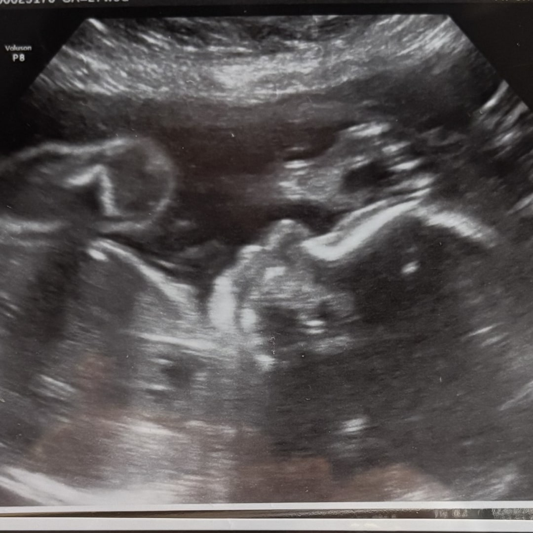 Photo shared by Andrea for their Babylist baby registry.
