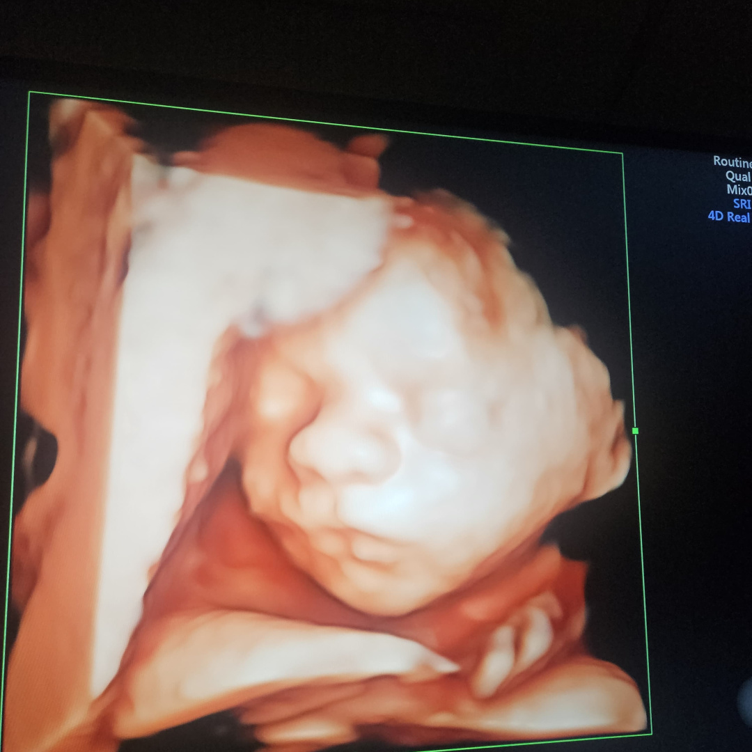Photo shared by Kierstan for their Babylist baby registry.