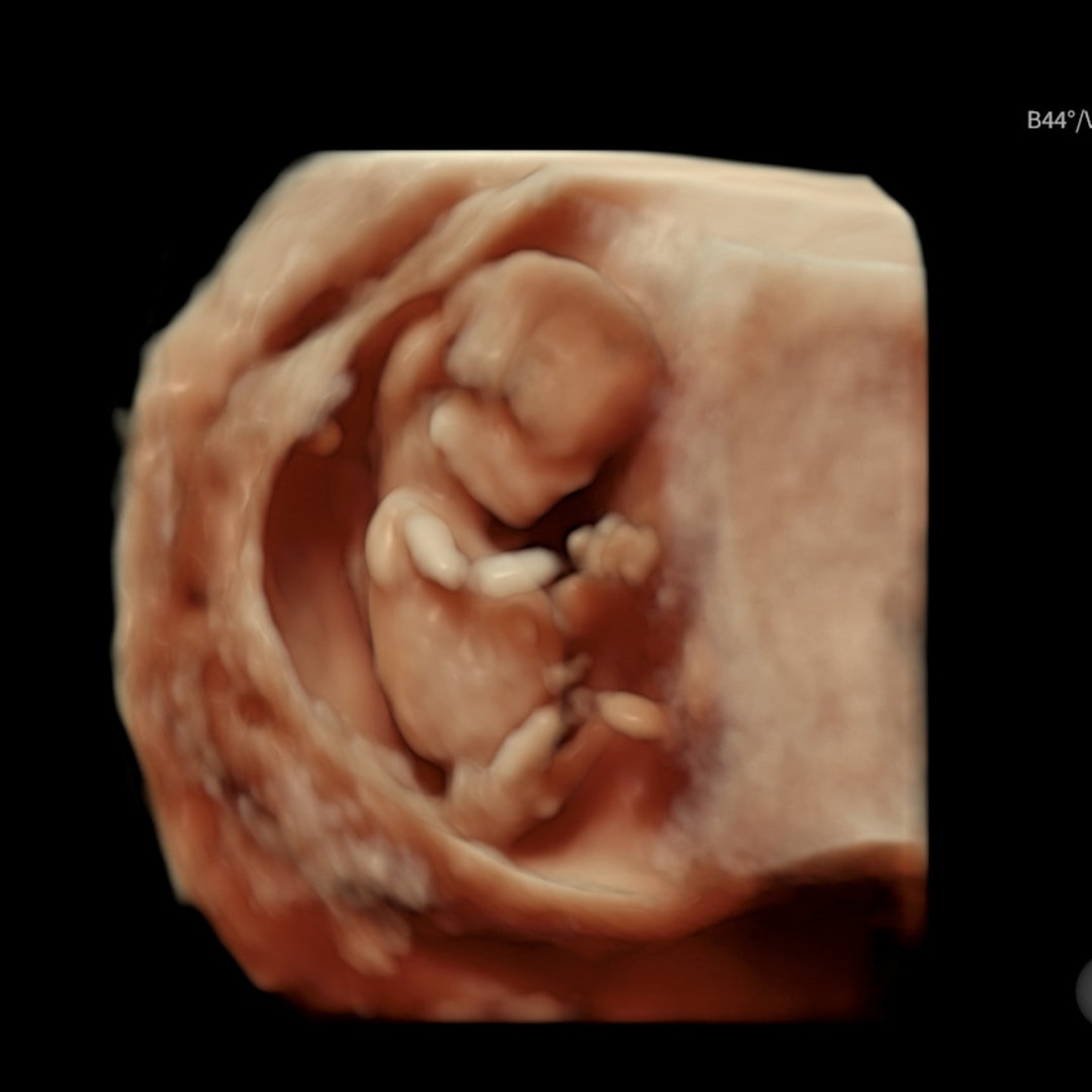 Photo shared by Jessica for their Babylist baby registry.