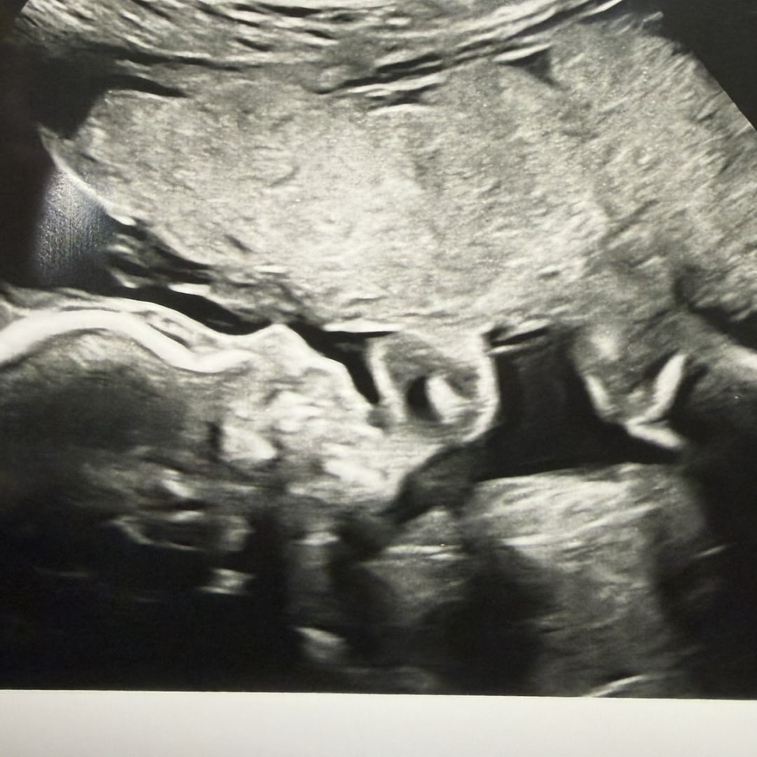 Photo shared by JoAnna for their Babylist baby registry.