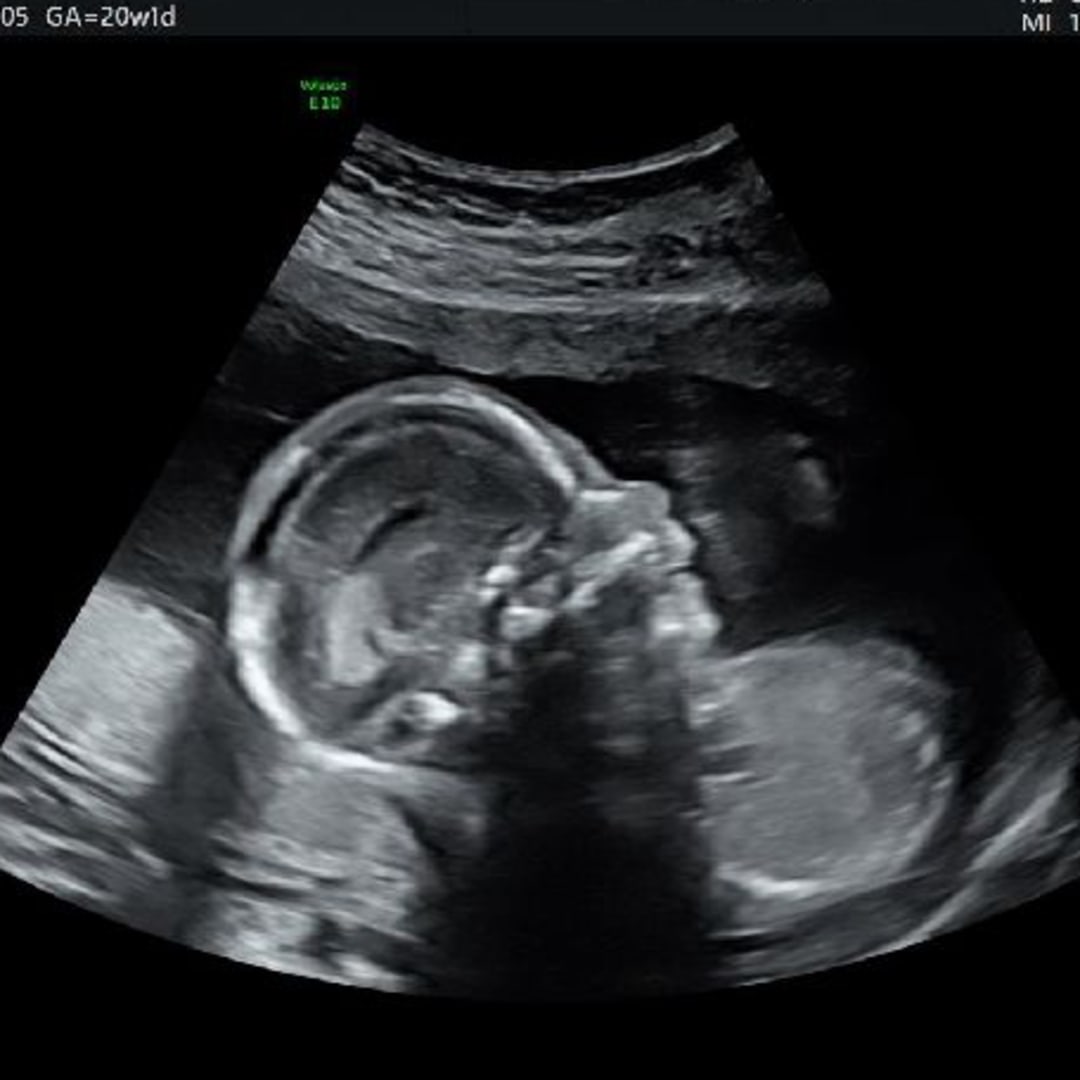 Photo shared by Celeste for their Babylist baby registry.