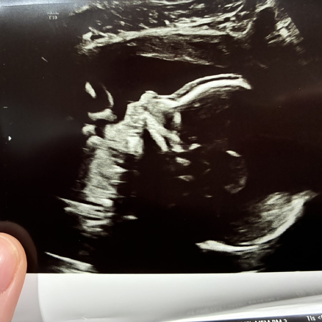 Photo shared by Katelyn for their Babylist baby registry.