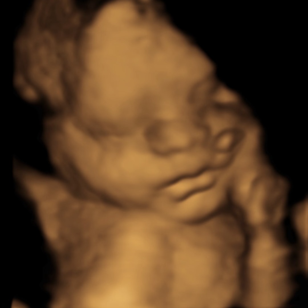 Photo shared by Brittany for their Babylist baby registry.