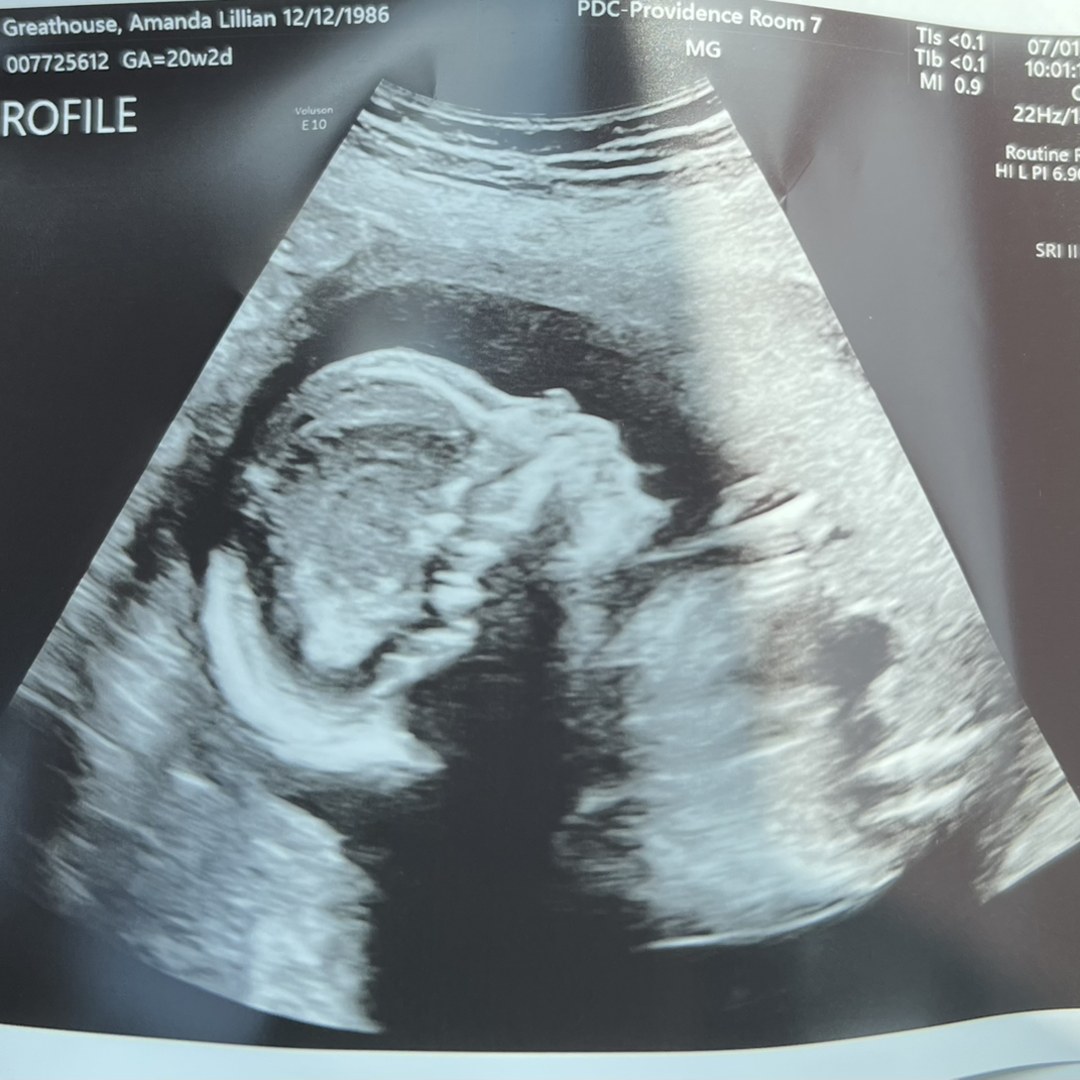 Photo shared by Amanda for their Babylist baby registry.