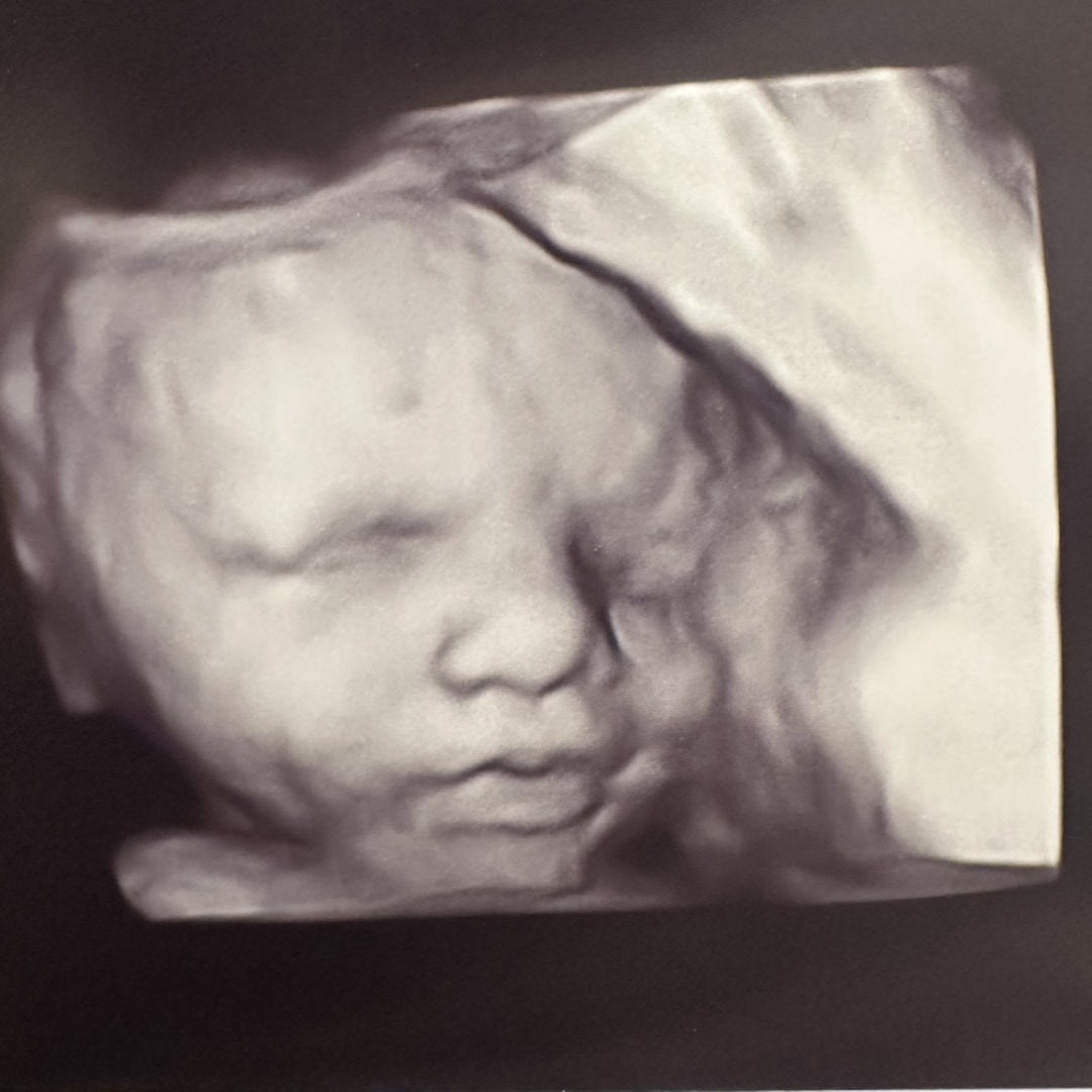 Photo shared by Shelby for their Babylist baby registry.