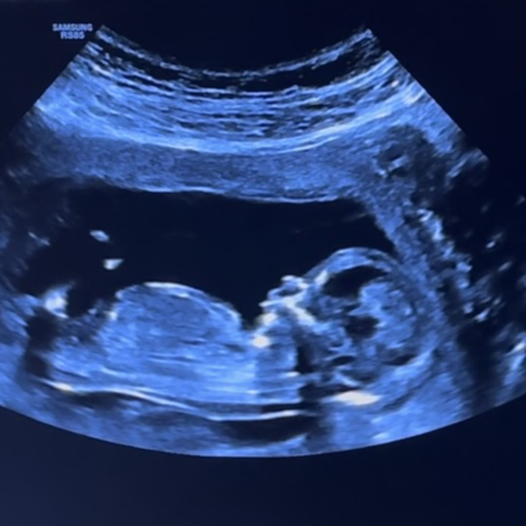 Photo shared by Doris for their Babylist baby registry.